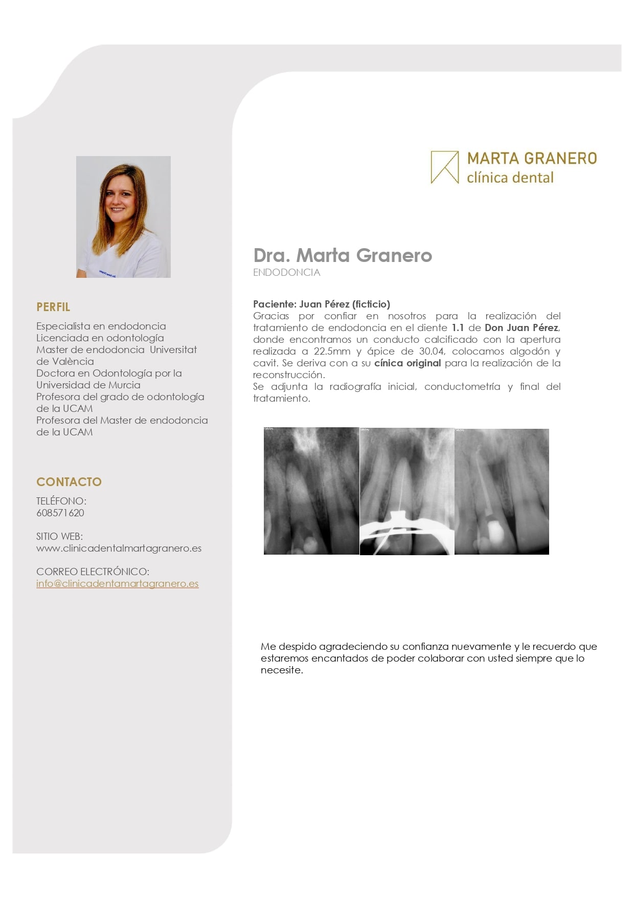 endodoncia complicada
