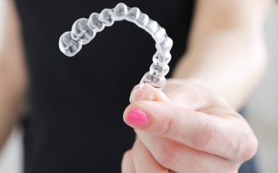 Ortodoncia invisible en Murcia: ¿Invisalign o Spark?