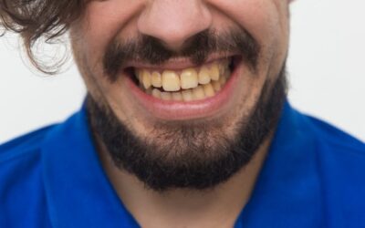 Todo sobre la aparición del sarro en los dientes