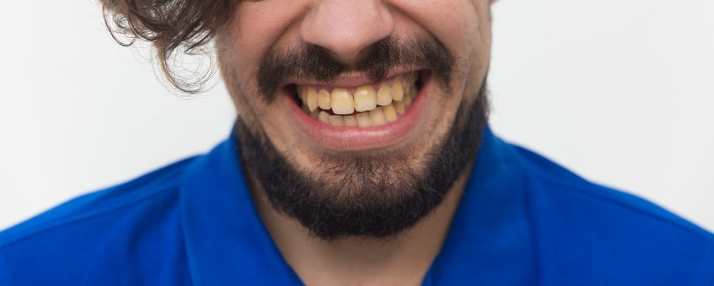 Sarro dental